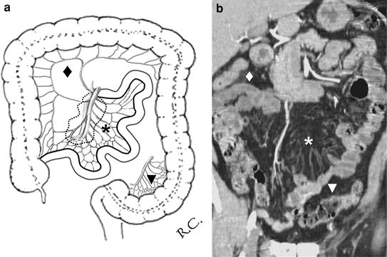 mesenteric-and-retroperitoneal-diseases-springerlink