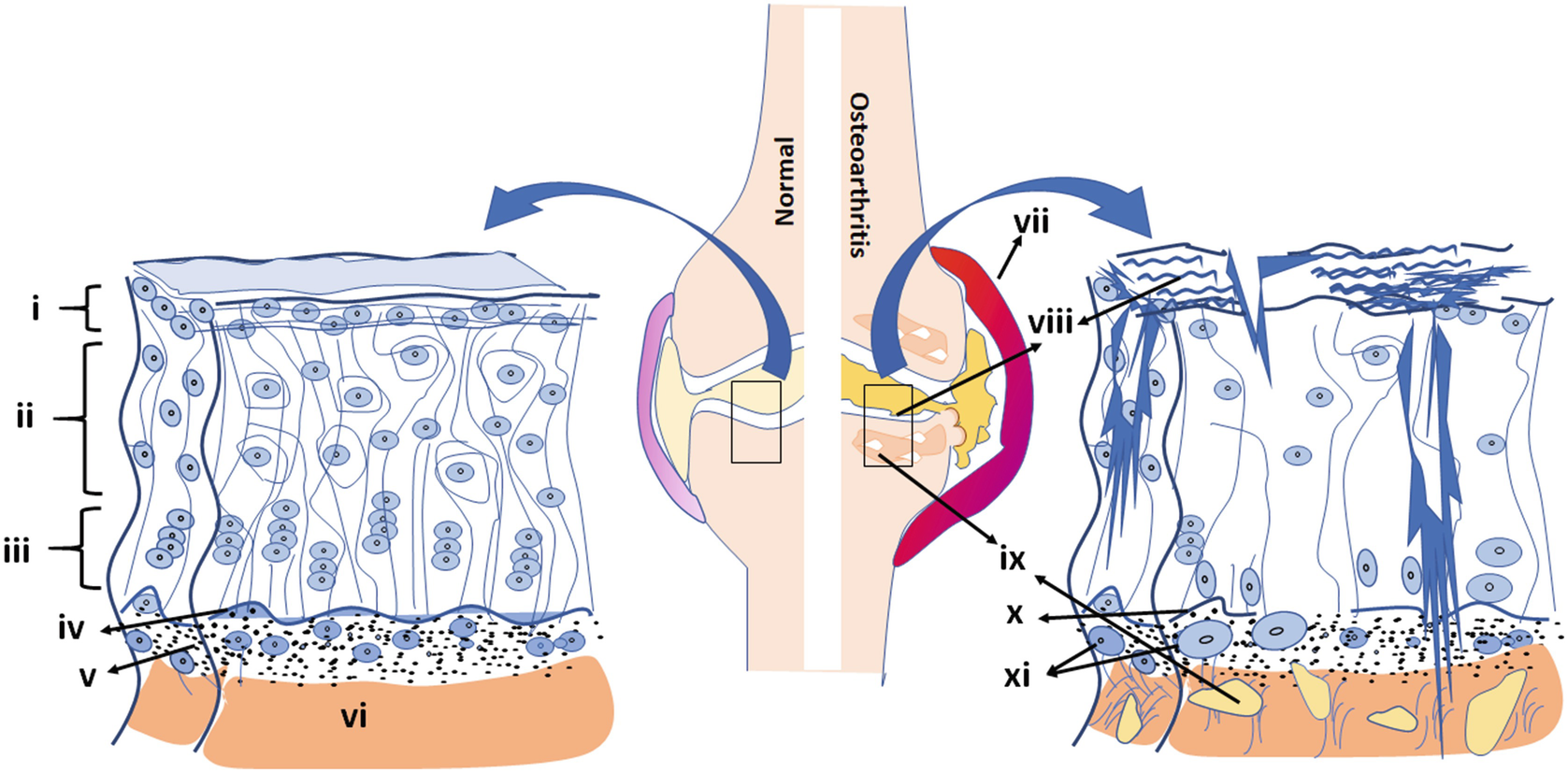 A Comprehensive Review Of Stem Cells For Cartilage Regeneration In 