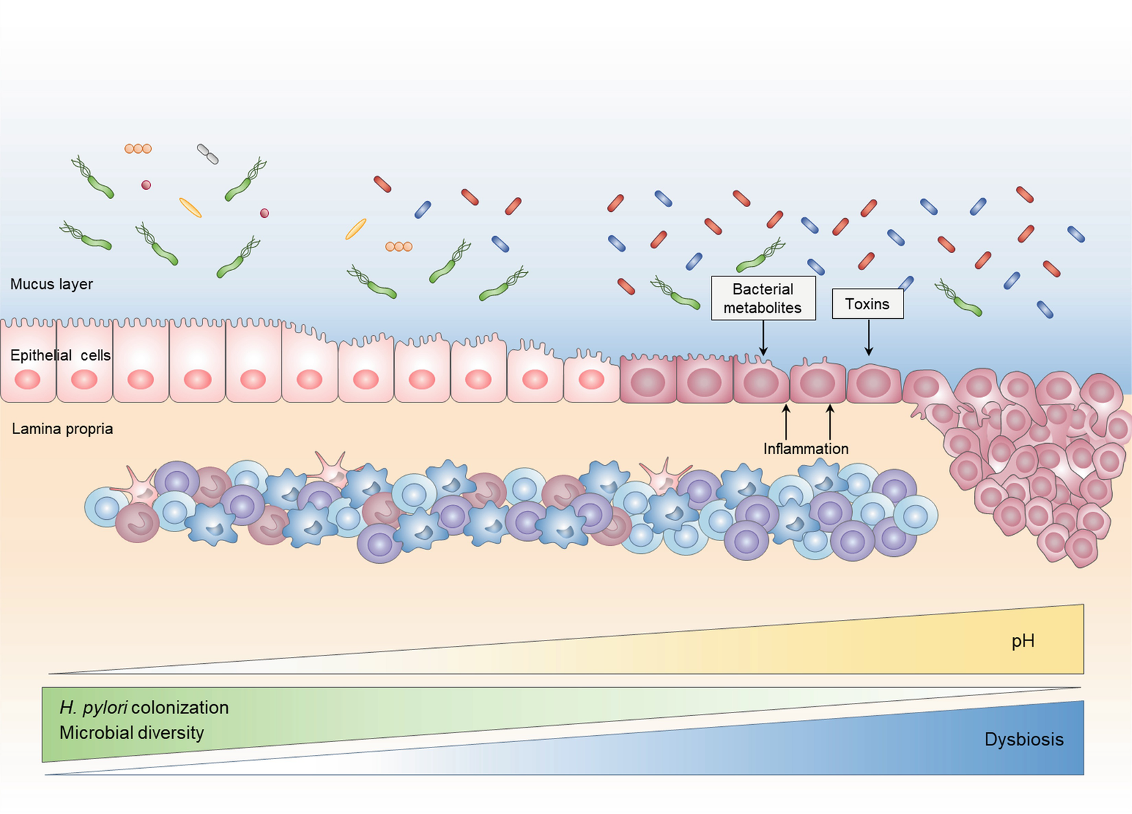 Helicobacter pylori : aktualitások, érdekességek H pylori dysbiosis