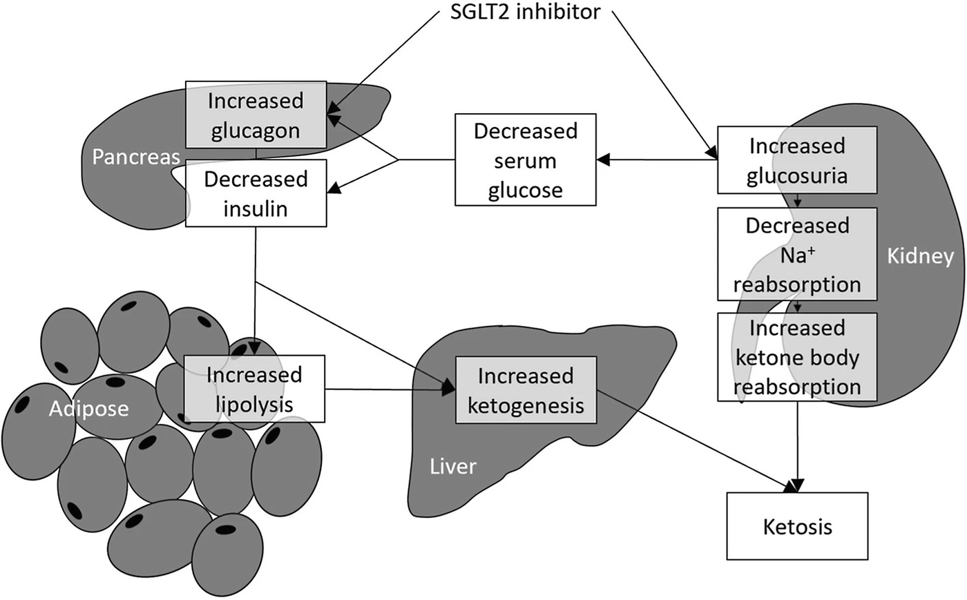 ketoacidosis a cukorbetegség kezelésének