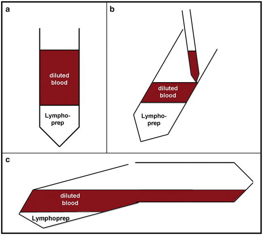 Peripheral Blood Mononuclear Cells Isolation Freezing Thawing And Culture Springerlink