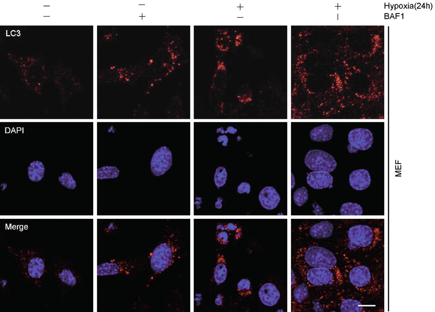 Immunofluorescence Staining Protocols for Major Autophagy Proteins