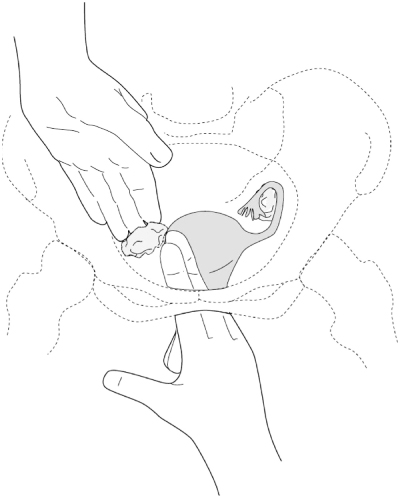 pelvic examination figure