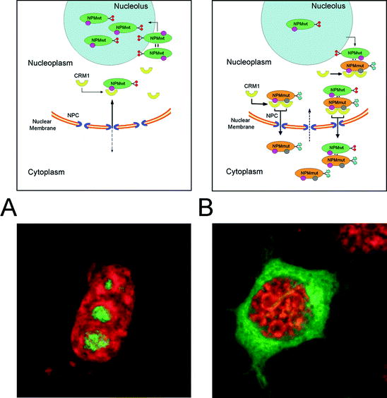 Acute Myeloid Leukemia with Mutated Nucleophosmin (NPM1): Molecular ...
