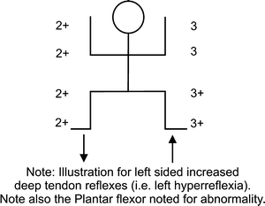 Deep Tendon Reflex Chart
