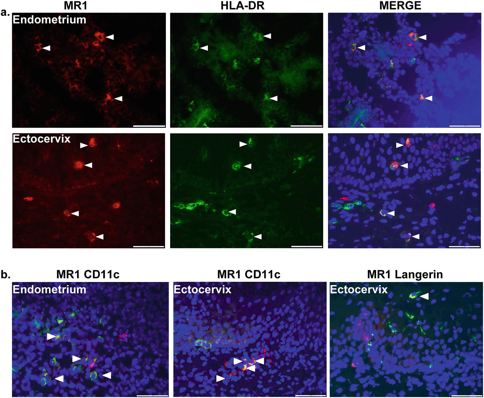 In Situ Detection of MAIT Cells and MR1-Expressing Cells in Tissue ...