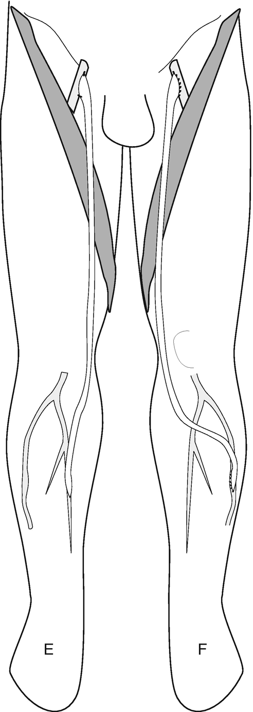 Basic Steps in Vascular Reconstructions  SpringerLink