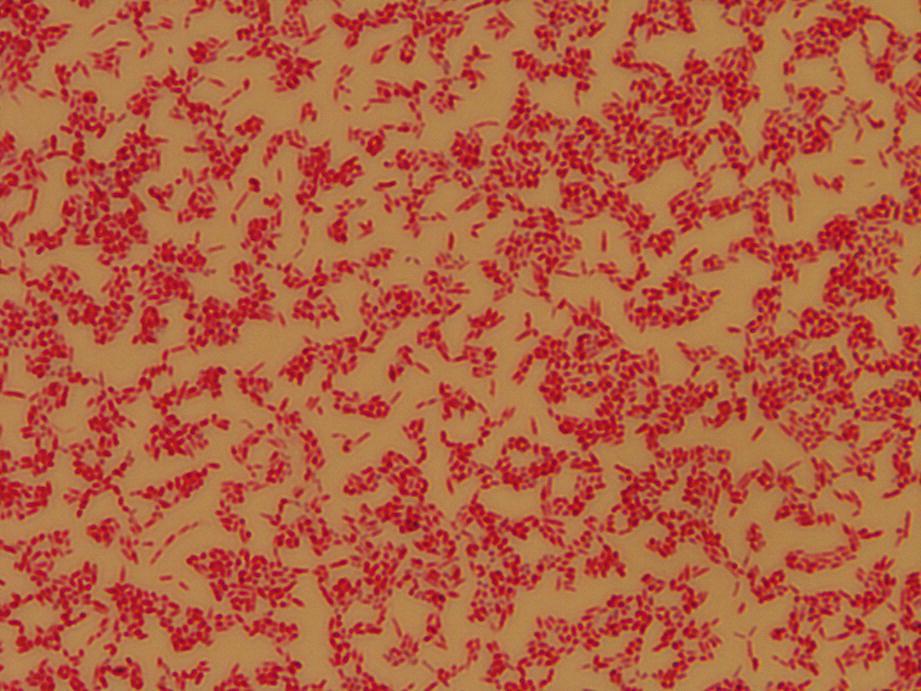 Culturing Mycobacteria Springerlink Culturing Mycobacteria Springerlink