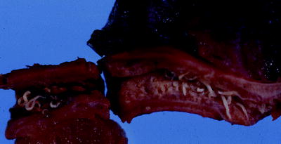 a pinworms vermacar ból gyógyszerek a test megtisztítására a parazitáktól