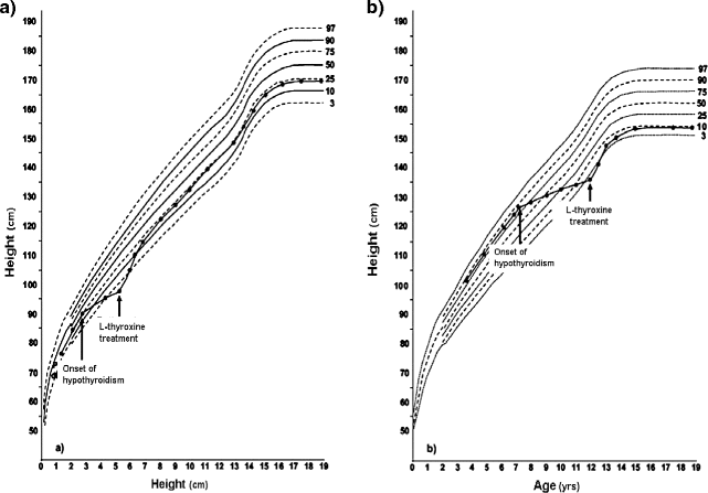 Thyroid Function During Catch Up Growth A Focus On The Growth Plate Springerlink
