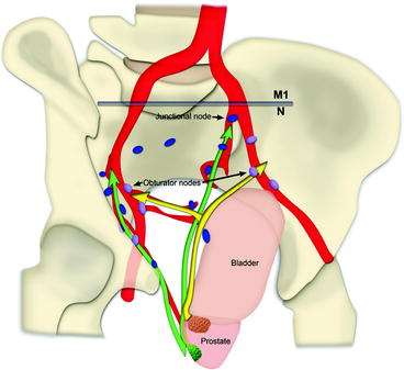 Pelvic Lymph Nodes | SpringerLink