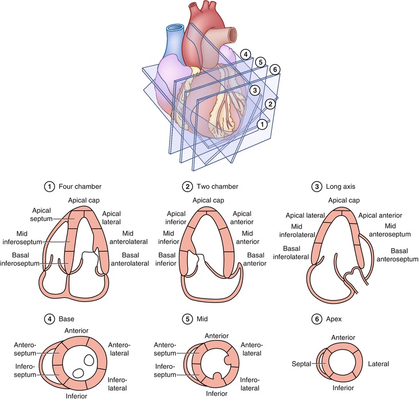 Echocardiographic Evaluation of Coronary Artery Disease | SpringerLink