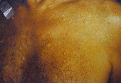 Cysts Springerlink