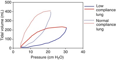 Respiratory Monitoring Springerlink
