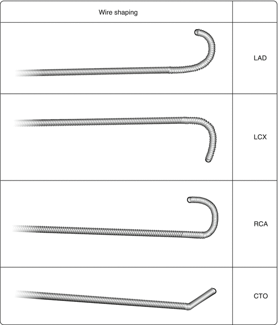 Guidewire Properties and Selection SpringerLink