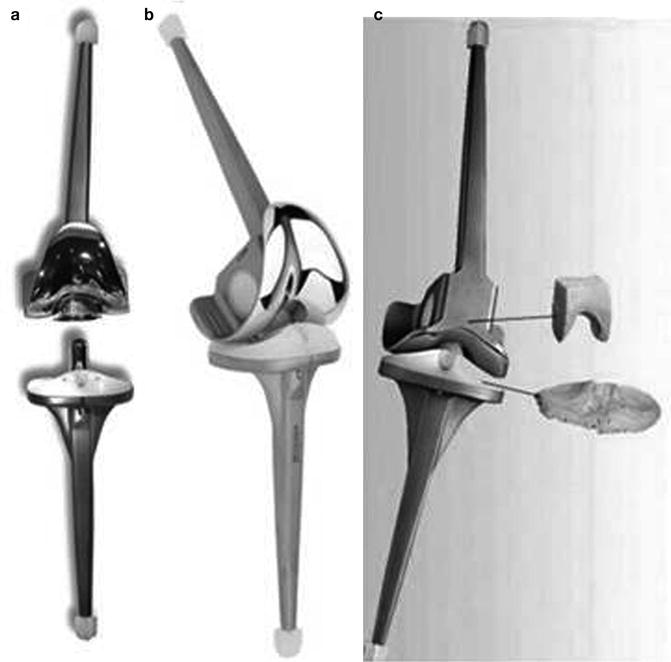 Long Term of Total Knee Arthroplasty Rotating Hinge Designs SpringerLink