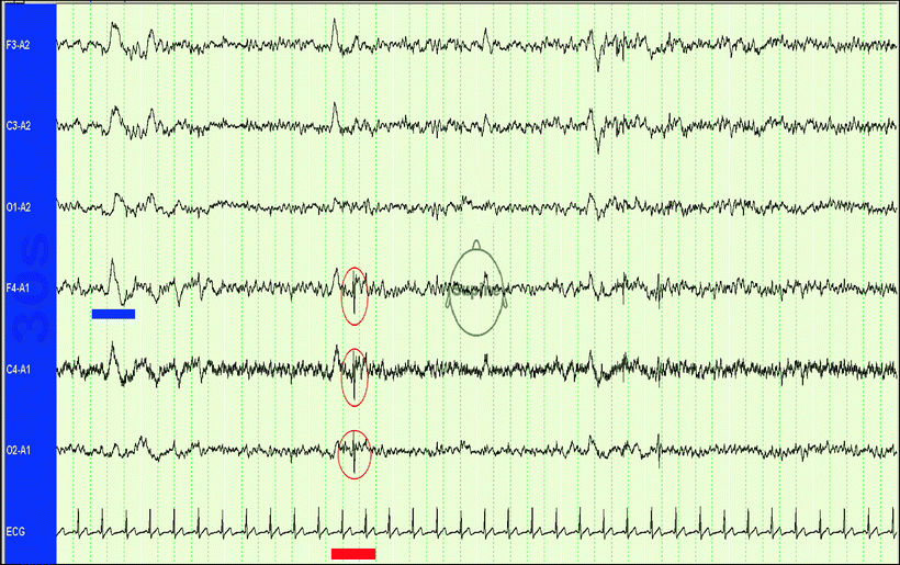 Artifacts SpringerLink