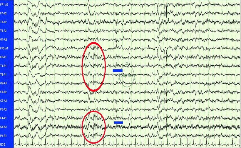 Artifacts SpringerLink