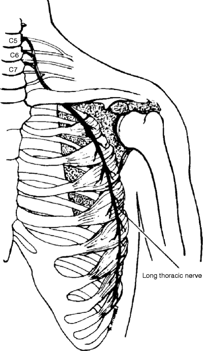 Compressive and Entrapment Neuropathies of the Upper Extremity