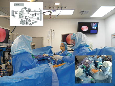 Hip Arthroscopy Lateral Approach To Patient Positioning