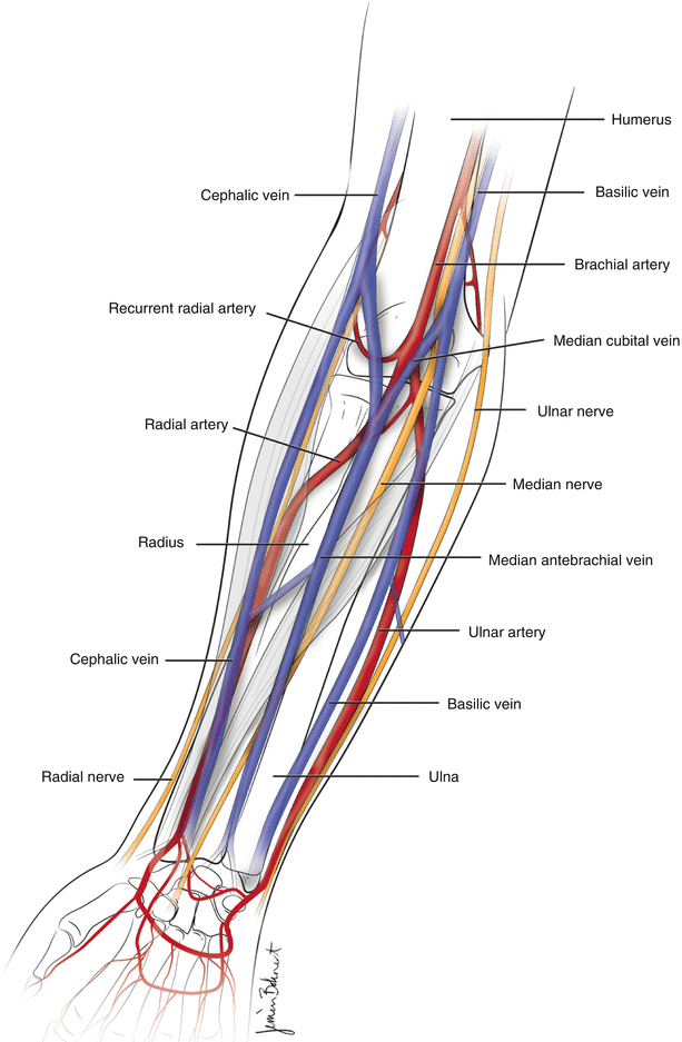 Radial and Brachial Access | SpringerLink