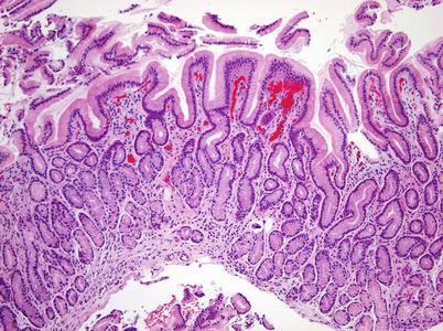 Gastric Cardia Histology