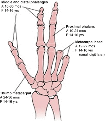 Pediatric Phalanx Fractures: Evaluation and Management | SpringerLink