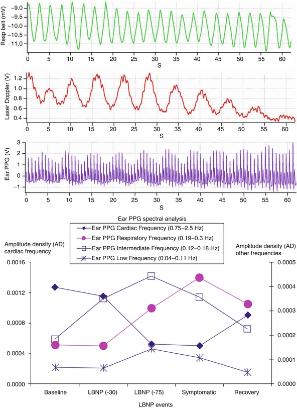 Photoplethysmography Analysis of the Pulse Oximeter Waveform