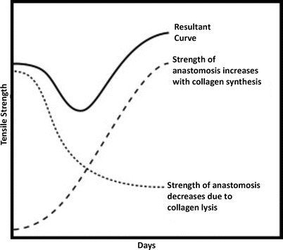 The Failed Anastomosis Springerlink