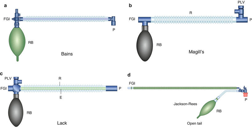 Anesthesia Machine | SpringerLink