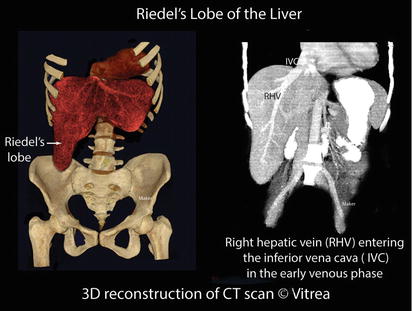Liver | SpringerLink
