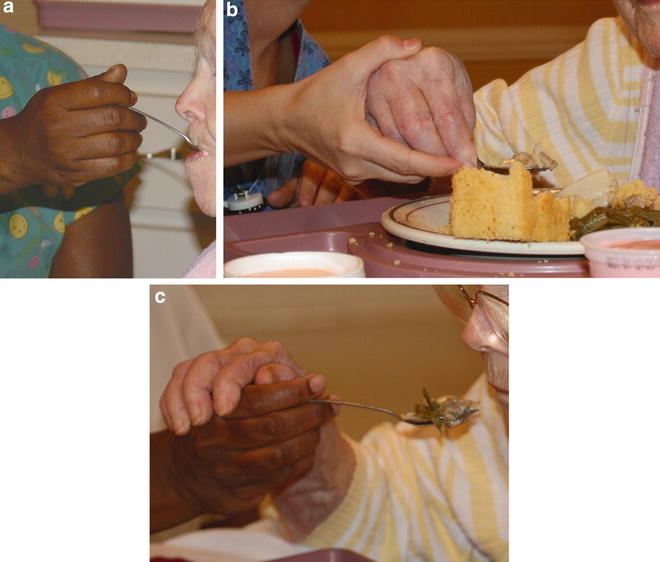 DementiaRelated Mealtime Difficulties Assessment and Management in