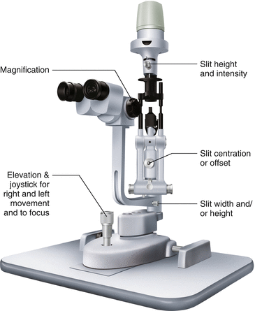 Slit Lamp Examination | SpringerLink