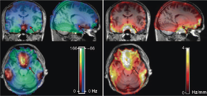 fMRI of Emotion | SpringerLink
