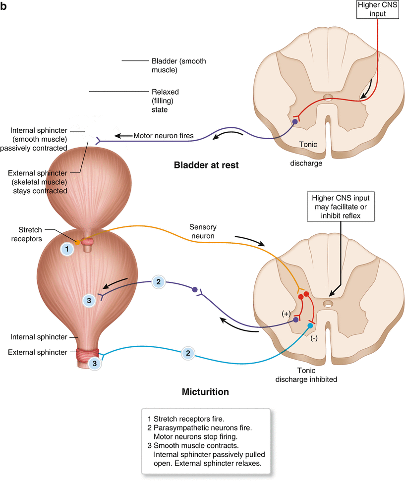 The Neurogenic Bladder And Hypertonic Pelvic Floor Muscle