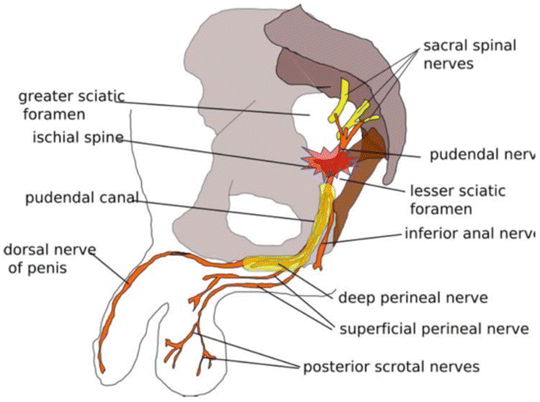 Chronic Pelvic Pain Pudendal Neuralgia And Therapeutic Neural Blockade Springerlink