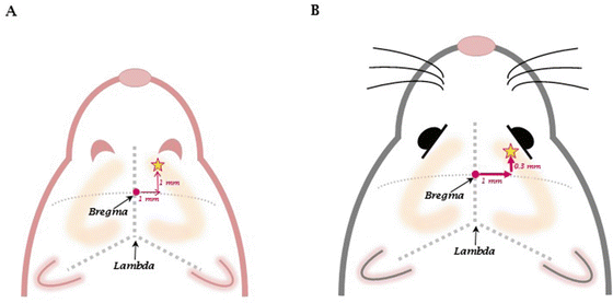 Mouse Icv Injection Position Intracerebroventricular Delivery in Mice for Motor Neuron Diseases ...