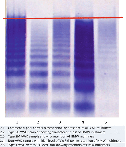 Laboratory Testing for Von Willebrand Factor Multimers | SpringerLink
