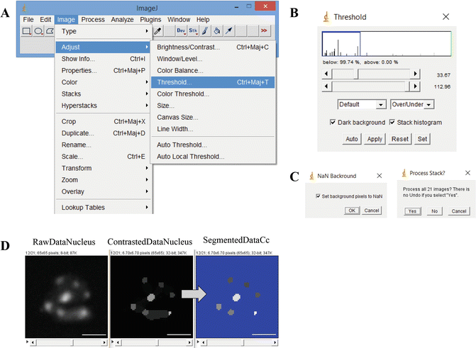 Quantitative 3d Analysis Of Nuclear Morphology And