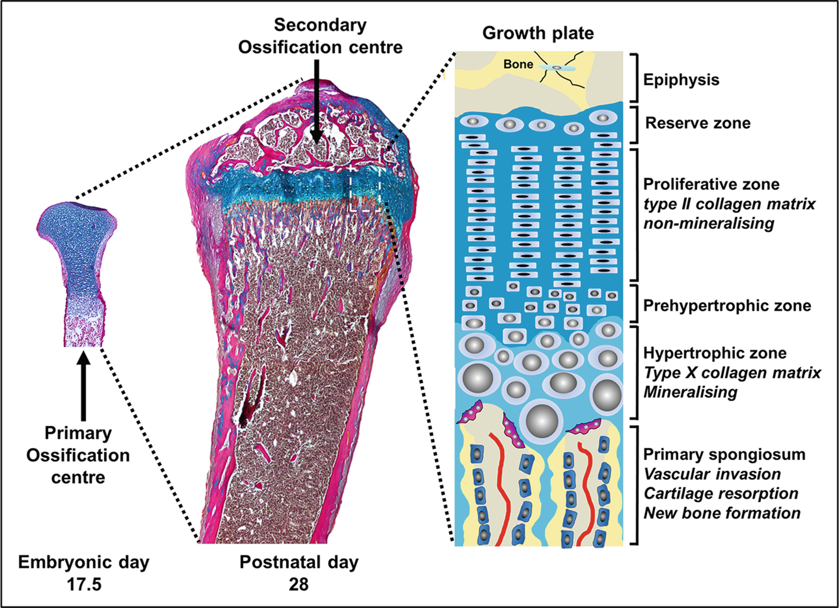 40+ Endochondral Ossification Zones Pictures