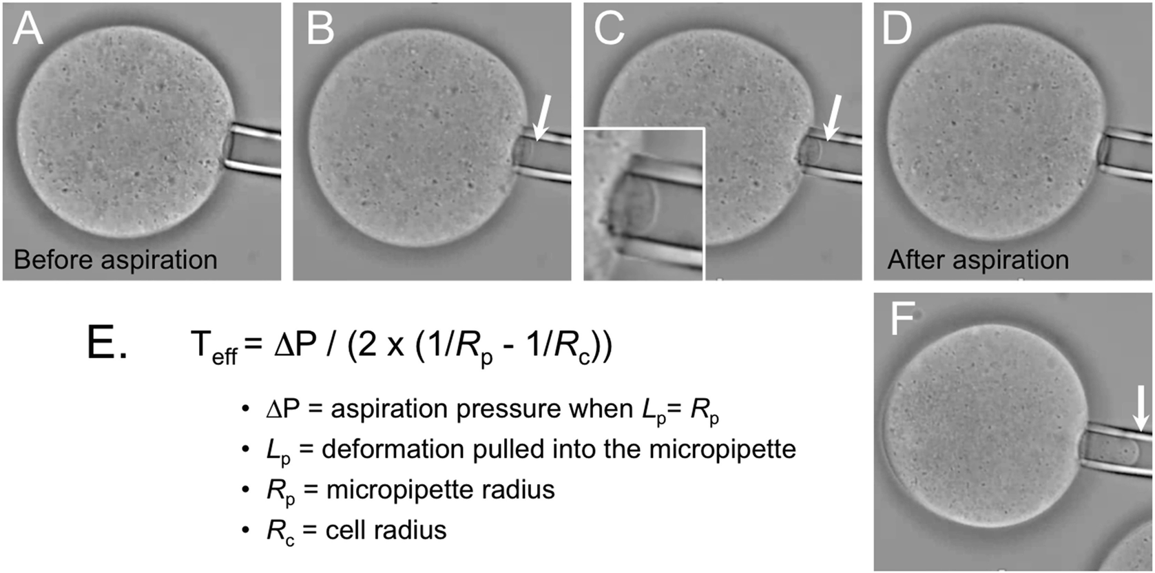 Micropipette Aspiration of Oocytes to Assess Cortical Tension SpringerLink