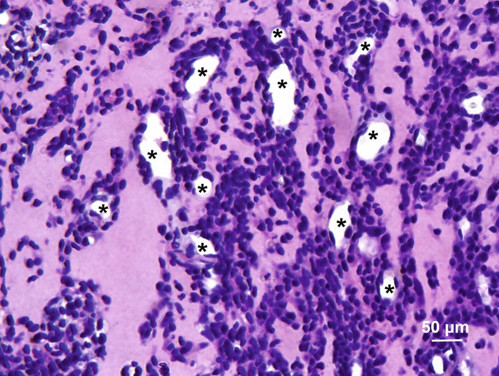 Matrigel Plug Assay For In Vivo Evaluation Of Angiogenesis Springerlink