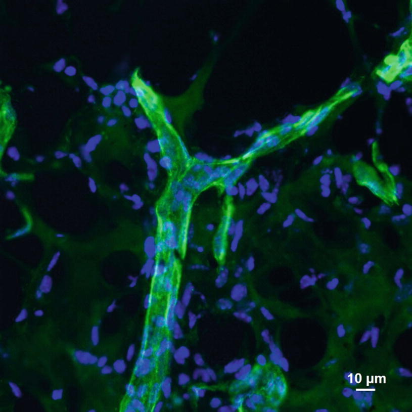 Matrigel Plug Assay For In Vivo Evaluation Of Angiogenesis Springerlink