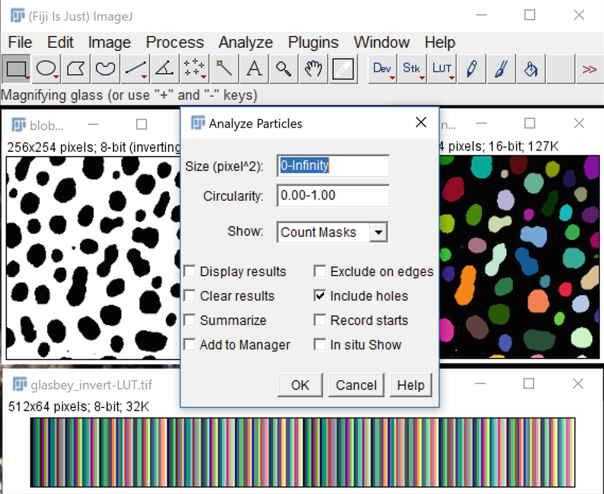 Main Steps In Image Processing And Quantification The