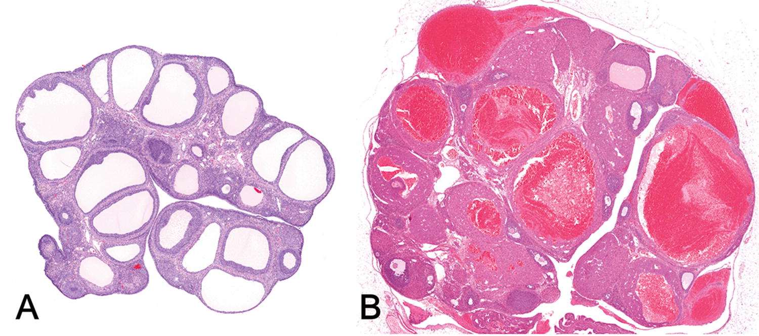 Pathology maladies reproductive system webquest Pathology maladies reproductive system webquest