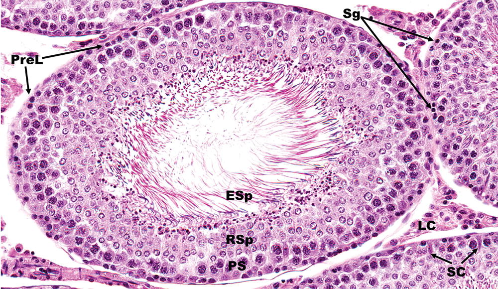 Pathology Maladies Reproductive System Pathology Maladies Reproductive System