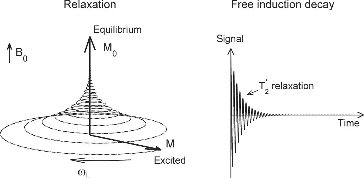Magnetic Resonance Imaging Springerlink