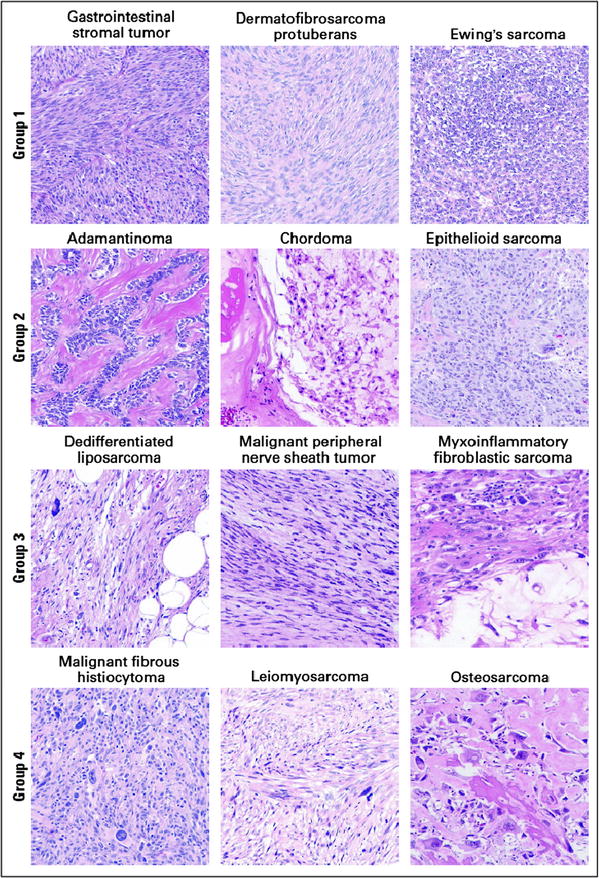 Biotargets In Sarcomas The Past Present And A Look Into The Future Springerlink