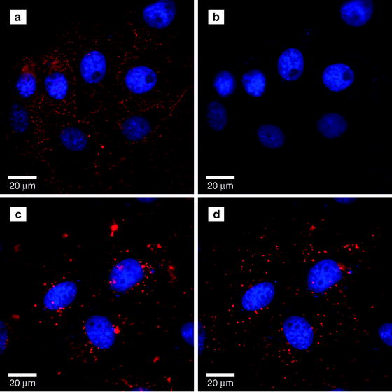 Imaging Intracellular Quantum Dots Fluorescence Microscopy and
