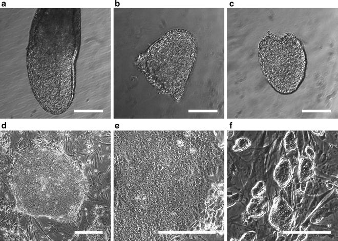 Reversion Of Mouse Postimplantation Epiblast Stem Cells To A Naïve ...